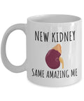 Kidney Recipient Mug Kidney Transplant Gift Kidney Surgery Present New Kidney Same Amazing Me Graphic Tee – Bold Style · Top Pick For Any Outfit